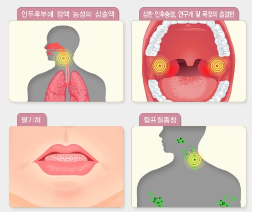 광주 성홍열 급증.jpg